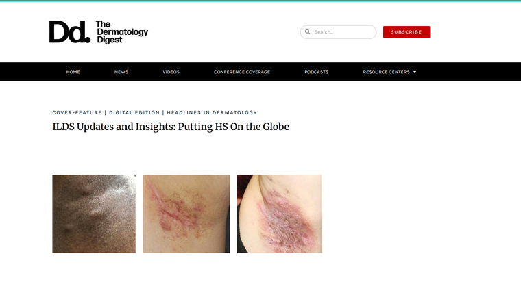 ILDS Updates and Insights: Putting HS On the Globe